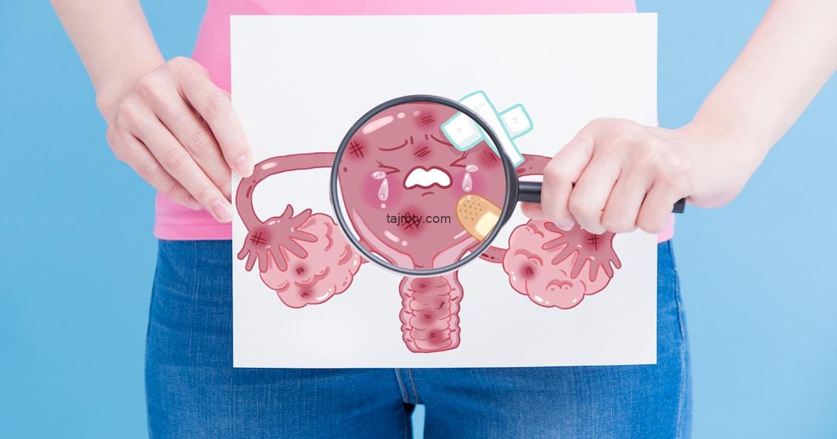  تجربتي مع الزعفران لفتح الرحم لتسهيل الولادة