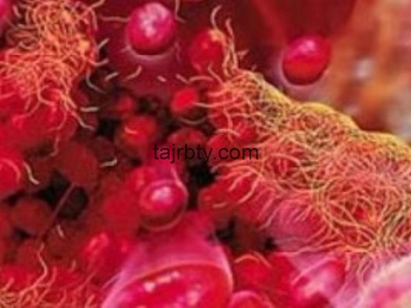 تجربتي مع نقص الصفائح الدموية وطرق العلاج بالتفصيل