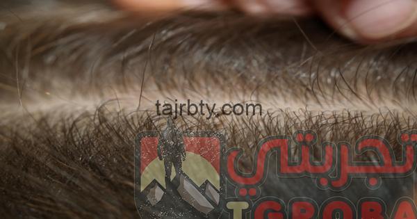 ما هو تفسير حلم القمل في المنام كامل