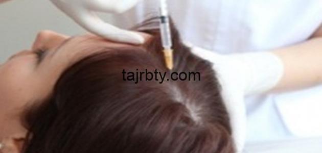 شرح طريقة زراعة الشعر في المنزل