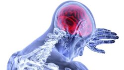علاج نقص الدم في المخ علاج نقص الدم في المخ